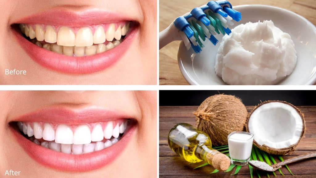 Smiling woman using coconut oil for teeth whitening